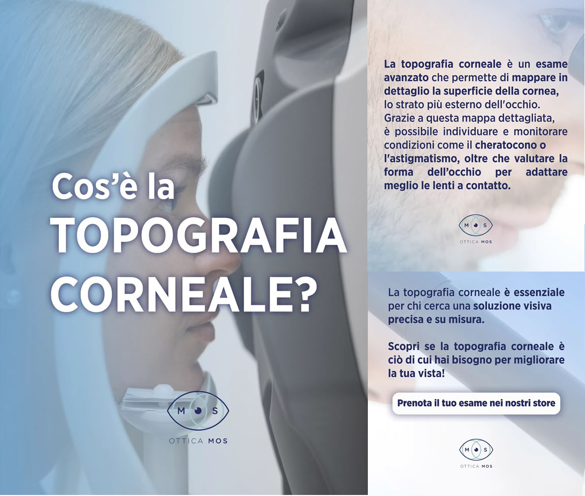 Cos’è la Topografia Corneale